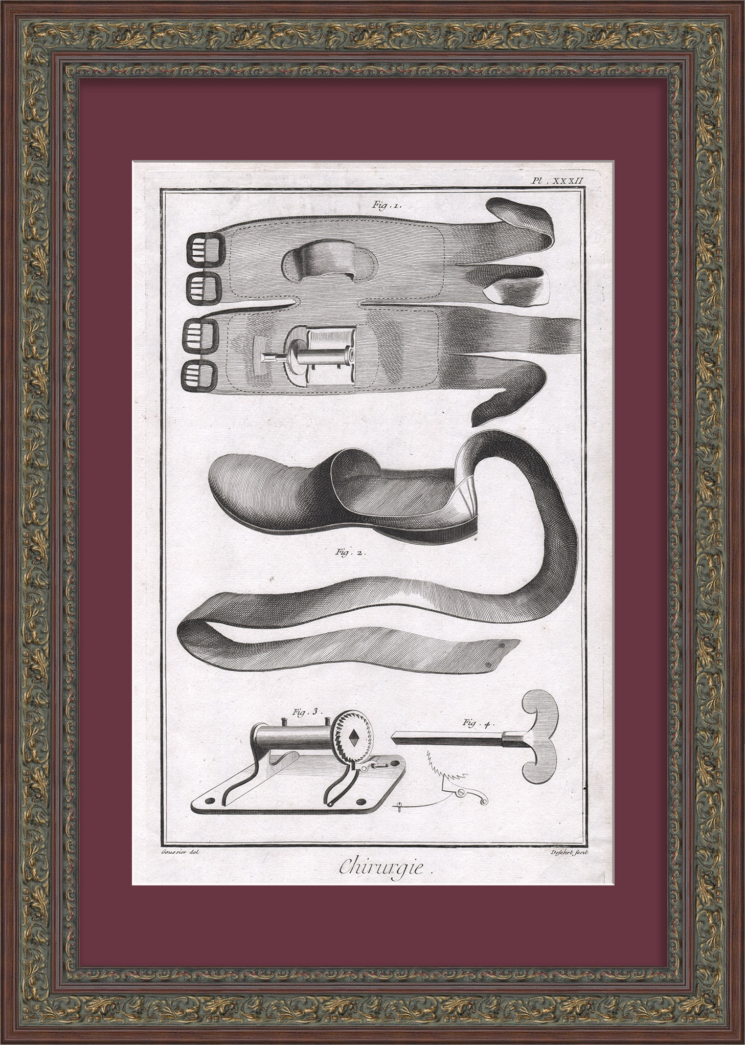 Хирургия: лечение Ахиллова сухожилия. Уникальная гравюра 18 века Хирургия: лечение Ахиллова сухожилия. Уникальная гравюра 18 века