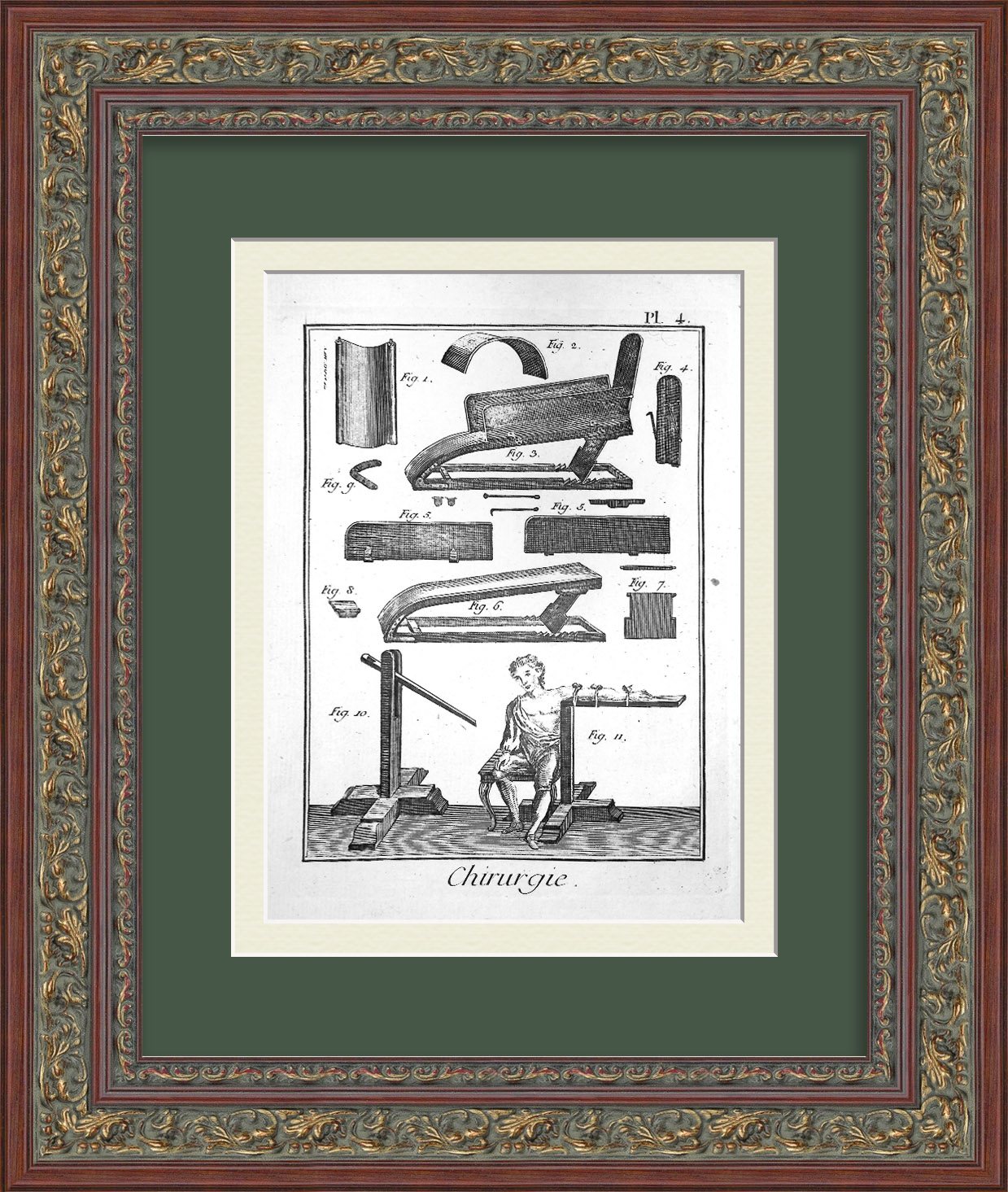 Травматология 18 века, лечение переломов. Старинная, редкая гравюра Травматология 18 века, лечение переломов. Старинная, редкая гравюра