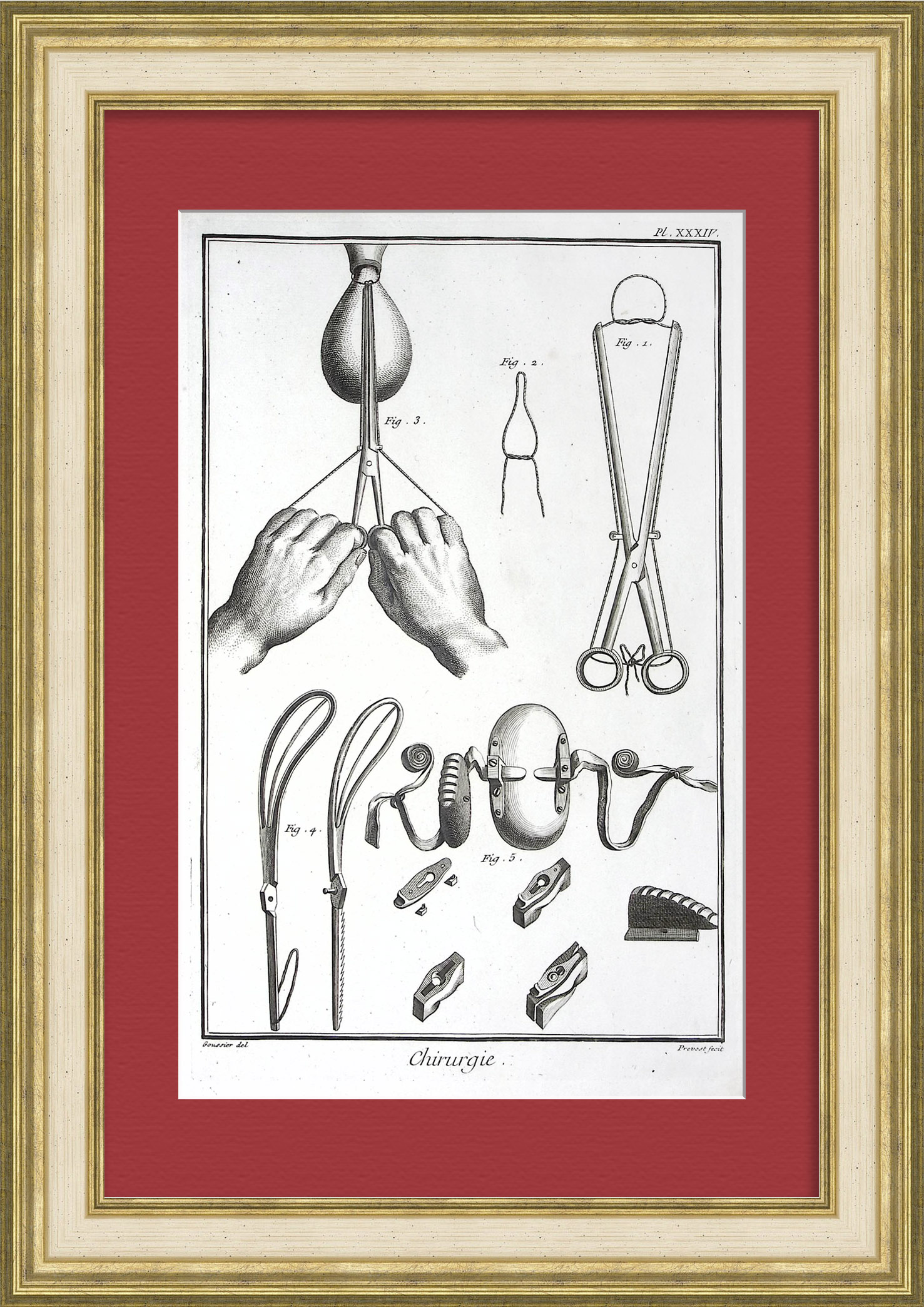 Акушерство в 18 веке, хирургия. Уникальная, старинная гравюра Акушерство в 18 веке, хирургия. Уникальная, старинная гравюра