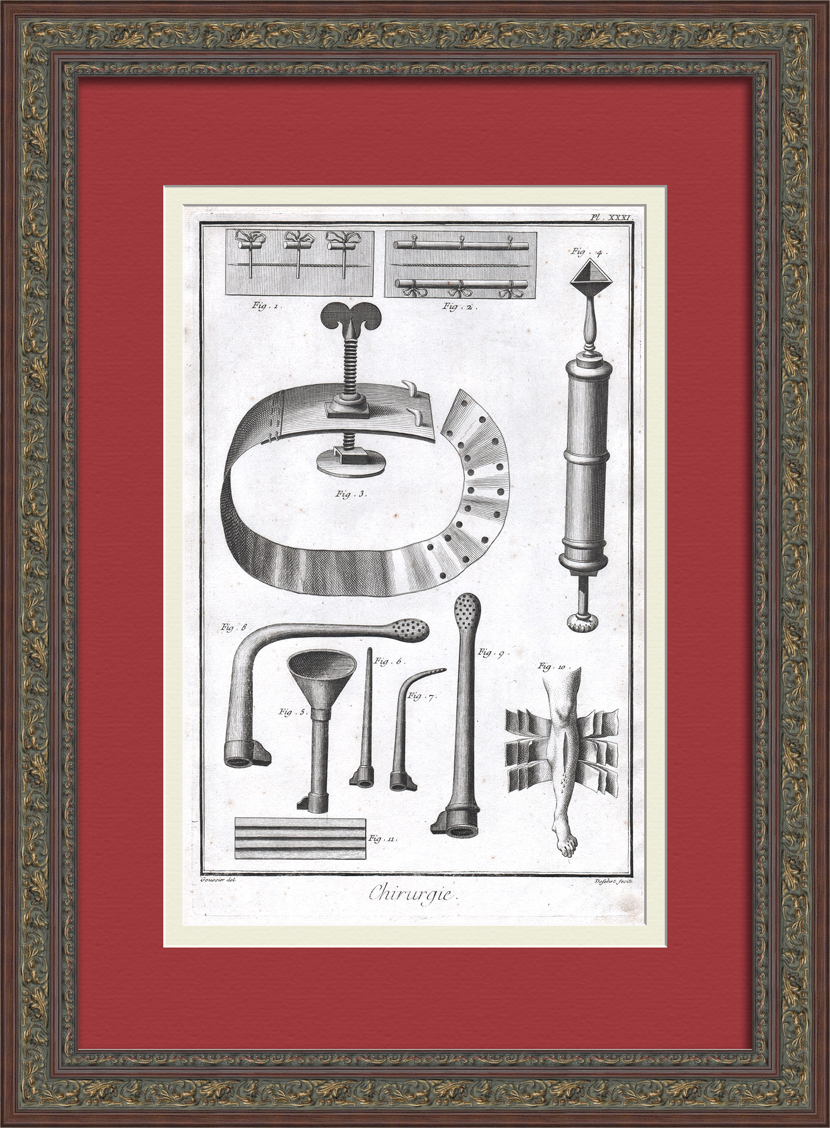 Хирургия: наложение швов и лечение переломов. Старинная гравюра 18 века Хирургия: наложение швов и лечение переломов. Старинная гравюра 18 века