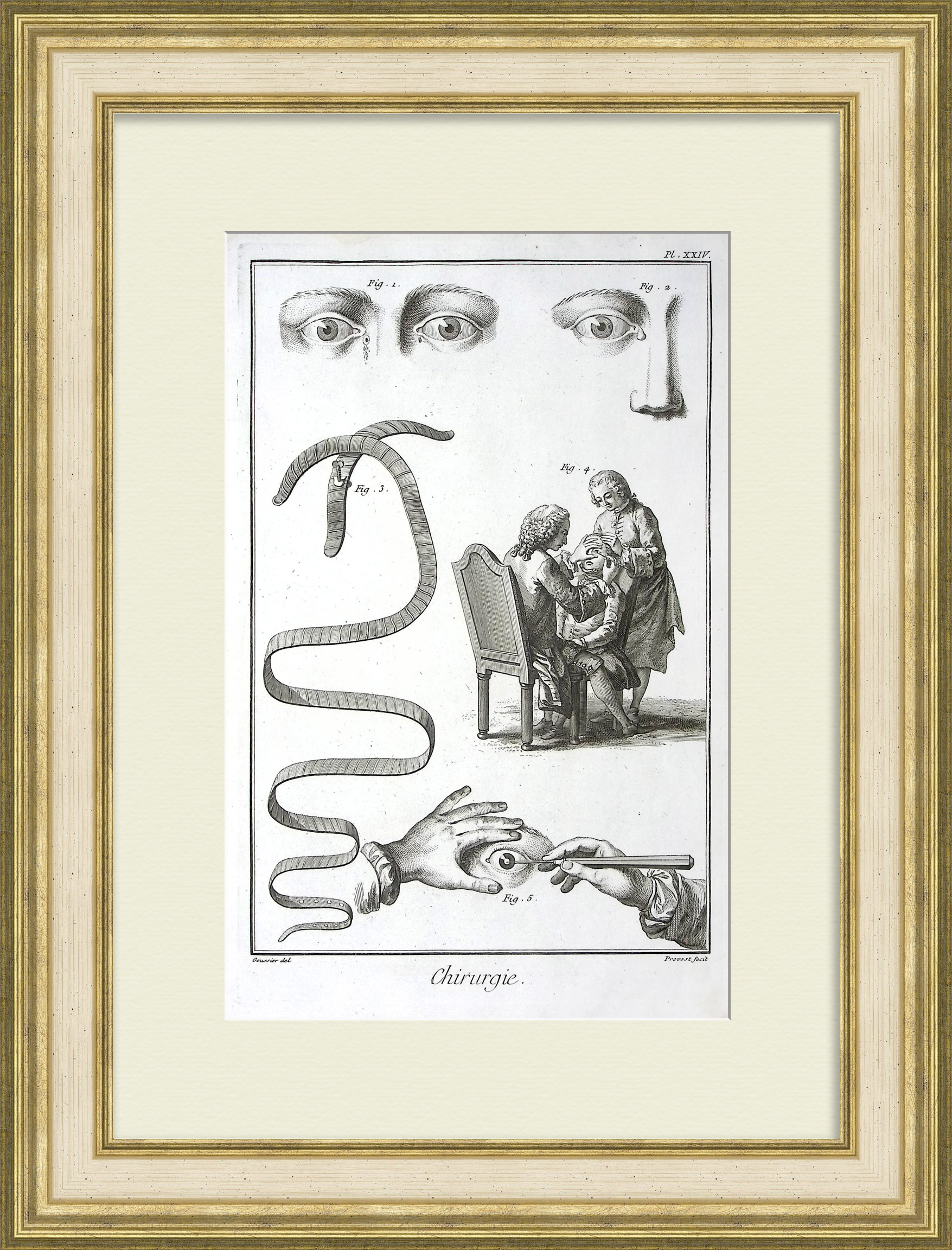 Хирургия глаза. Офтальмология в 18 веке, уникальная гравюра Хирургия глаза. Офтальмология в 18 веке, уникальная гравюра